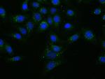 CTAGE5 Antibody in Immunocytochemistry (ICC/IF)