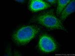 FDFT1 Antibody in Immunocytochemistry (ICC/IF)