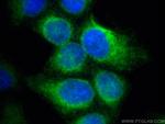 FDFT1 Antibody in Immunocytochemistry (ICC/IF)