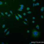FDFT1 Antibody in Immunocytochemistry (ICC/IF)