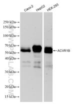 ACVR1B Antibody in Western Blot (WB)