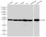 SCN4B Antibody in Western Blot (WB)
