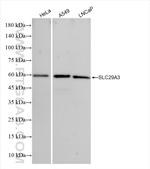 SLC29A3 Antibody in Western Blot (WB)