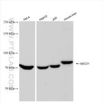 ABCD1 Antibody in Western Blot (WB)