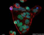 SALL4 Antibody in Immunocytochemistry (ICC/IF)
