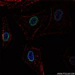 Acetyl-Histone H2A (Lys9) Antibody in Immunocytochemistry (ICC/IF)