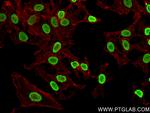 Acetyl-Histone H2A (Lys9) Antibody in Immunocytochemistry (ICC/IF)