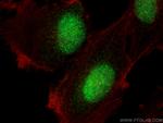MTA3 Antibody in Immunocytochemistry (ICC/IF)