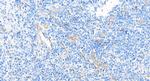 VEGF Receptor 2 Antibody in Immunohistochemistry (Paraffin) (IHC (P))