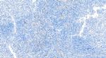 VEGF Receptor 2 Antibody in Immunohistochemistry (Paraffin) (IHC (P))