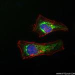 SURF1 Antibody in Immunocytochemistry (ICC/IF)