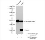 SURF1 Antibody in Immunoprecipitation (IP)