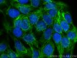 Cytokeratin 13 Antibody in Immunocytochemistry (ICC/IF)
