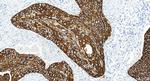Cytokeratin 13 Antibody in Immunohistochemistry (Paraffin) (IHC (P))