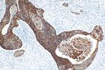 Cytokeratin 13 Antibody in Immunohistochemistry (Paraffin) (IHC (P))