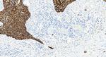 Cytokeratin 13 Antibody in Immunohistochemistry (Paraffin) (IHC (P))