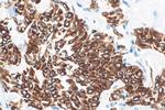 Cytokeratin 13 Antibody in Immunohistochemistry (Paraffin) (IHC (P))