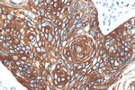 Cytokeratin 13 Antibody in Immunohistochemistry (Paraffin) (IHC (P))
