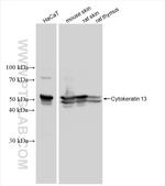 Cytokeratin 13 Antibody in Western Blot (WB)