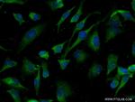 Tnfrsf11b Antibody in Immunocytochemistry (ICC/IF)