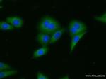 LCMT2 Antibody in Immunocytochemistry (ICC/IF)