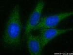 PFAS Antibody in Immunocytochemistry (ICC/IF)