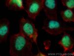 p300 Antibody in Immunocytochemistry (ICC/IF)