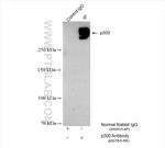 p300 Antibody in Immunoprecipitation (IP)