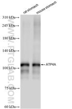 ATP4A Antibody in Western Blot (WB)