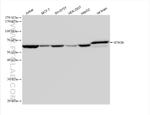 STK39 Antibody in Western Blot (WB)