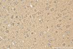 STK39 Antibody in Immunohistochemistry (Paraffin) (IHC (P))
