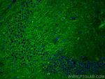 GDNF Antibody in Immunohistochemistry (PFA fixed) (IHC (PFA))