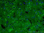 GDNF Antibody in Immunohistochemistry (PFA fixed) (IHC (PFA))