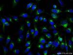 COPA Antibody in Immunocytochemistry (ICC/IF)