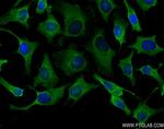 COPA Antibody in Immunocytochemistry (ICC/IF)