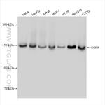 COPA Antibody in Western Blot (WB)