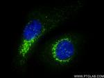 TGOLN2, TGN46 Antibody in Immunocytochemistry (ICC/IF)