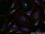 TGOLN2, TGN46 Antibody in Immunocytochemistry (ICC/IF)
