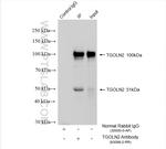 TGOLN2, TGN46 Antibody in Immunoprecipitation (IP)