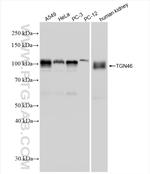 TGOLN2, TGN46 Antibody in Western Blot (WB)