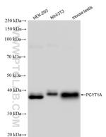 PCYT1A Antibody in Western Blot (WB)