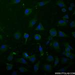 ODC1 Antibody in Immunocytochemistry (ICC/IF)