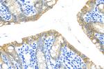 ZO-2 Antibody in Immunohistochemistry (Paraffin) (IHC (P))