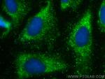 NEDD4 Antibody in Immunocytochemistry (ICC/IF)