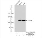 NEDD4 Antibody in Immunoprecipitation (IP)