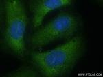 NEDD4 Antibody in Immunocytochemistry (ICC/IF)