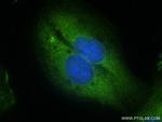 NEDD4 Antibody in Immunocytochemistry (ICC/IF)