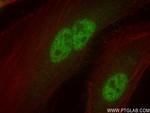 OGT Antibody in Immunocytochemistry (ICC/IF)