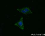 MMP1 Antibody in Immunocytochemistry (ICC/IF)