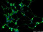 CELSR2 Antibody in Immunocytochemistry (ICC/IF)